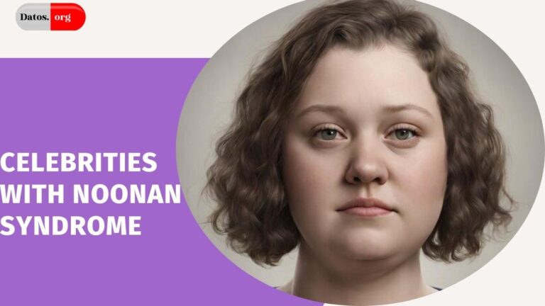 Celebrities with Noonan Syndrome