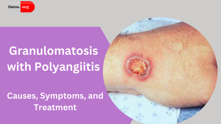 Granulomatosis with Polyangiitis